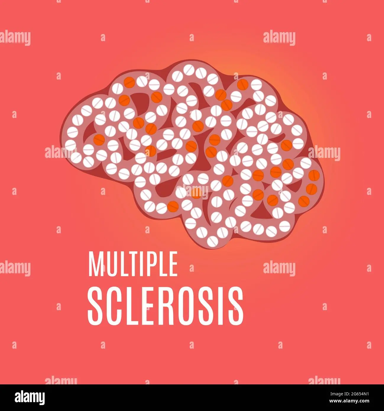 Scoperte Recenti sulla Molecola della Sclerosi Multipla image 1