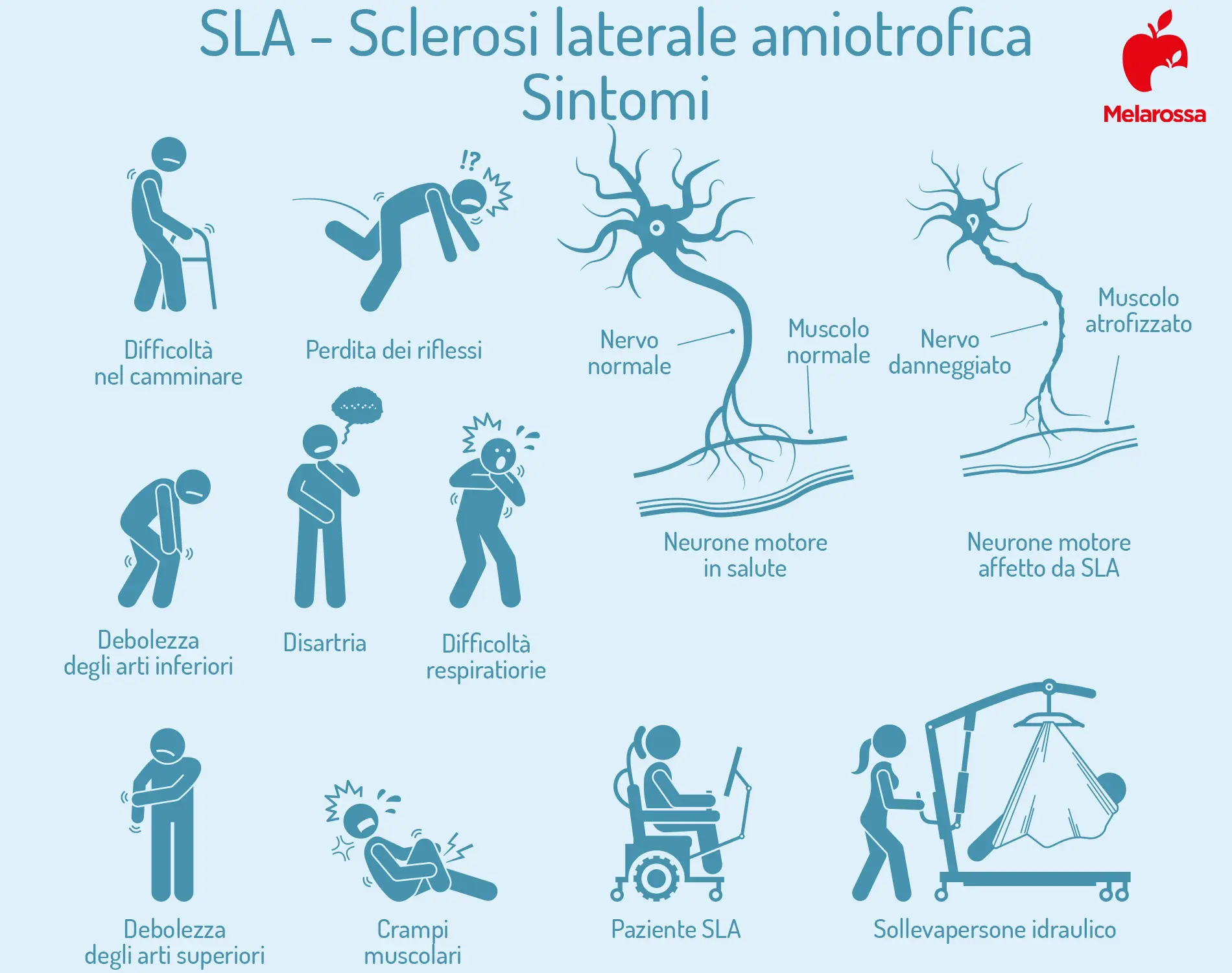 SLA Malattia: Impatti e Innovazioni nella Ricerca