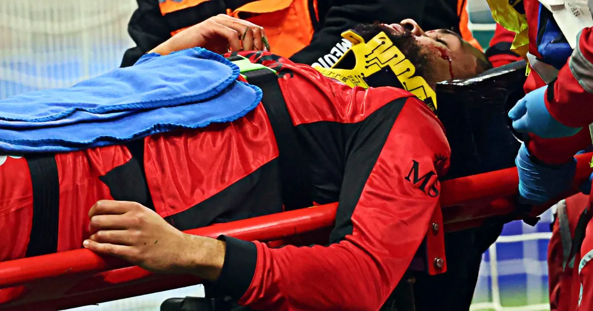 infortunio loftus cheek milan parma — IT news